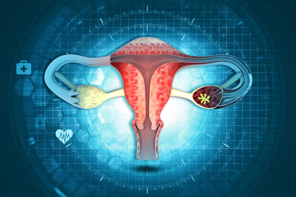 Uterus Fibroid గర్భాశయ కణితులు లక్షణాలు చికిత్స