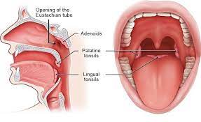 Tonsils Adenoids టాన్సిల్స్‌ ఎడినాయిడ్స్‌