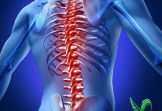 Spondylitis Treatment వెన్నునొప్పి ఆయుర్వేదం